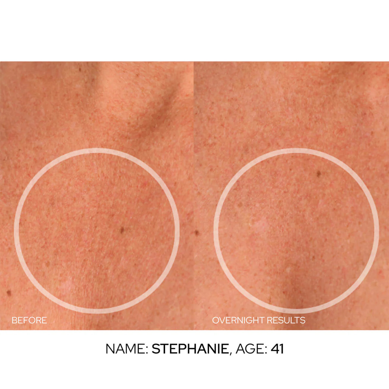 Anti-Aging Patch™, we Transform Your Skin from Home