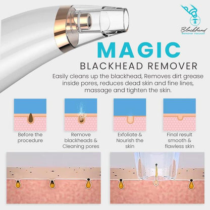 Blackhead Remover Vacuum